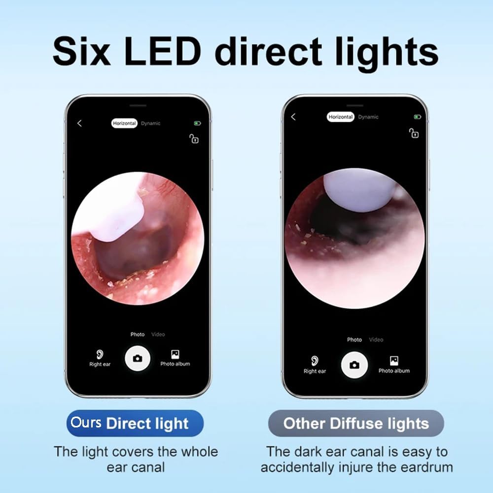 Ear Wax Removal Kit with Upgraded 1080p Camera, Ear Camera Otoscope with Light for iPhone, iPad, Android Phones
