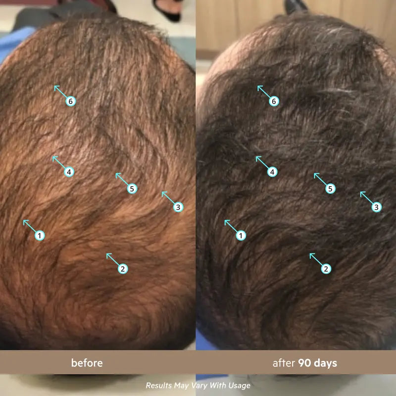 Men's Hair Density Serum