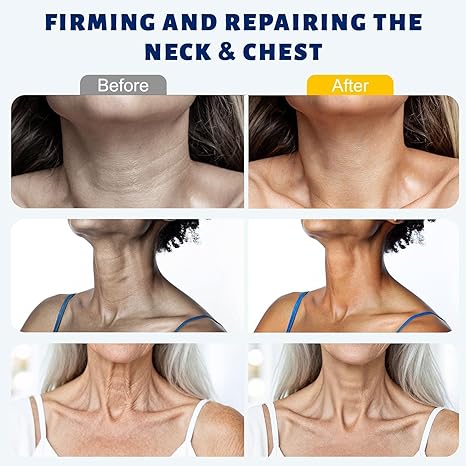 Niacinamide Neck Cream: Roller-Ball Massager for Lifting, Moisturizing, and Reducing Neck Lines