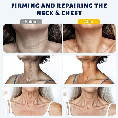 Niacinamide Neck Cream: Roller-Ball Massager for Lifting, Moisturizing, and Reducing Neck Lines