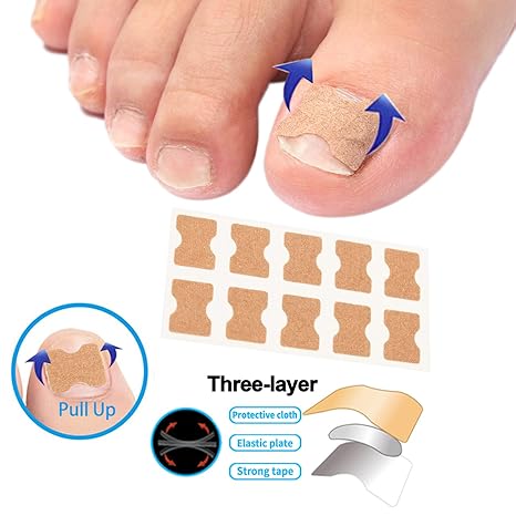 Professional Ingrown Toenail Toolkit with Breathable Ingrown Toenail Strips, Curved Toenails Corrector Patch