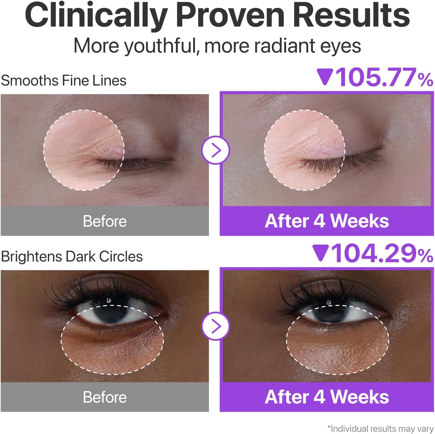 NAD+ Retinol Volumetox Eye Cream: Firming & Wrinkle Treatment
