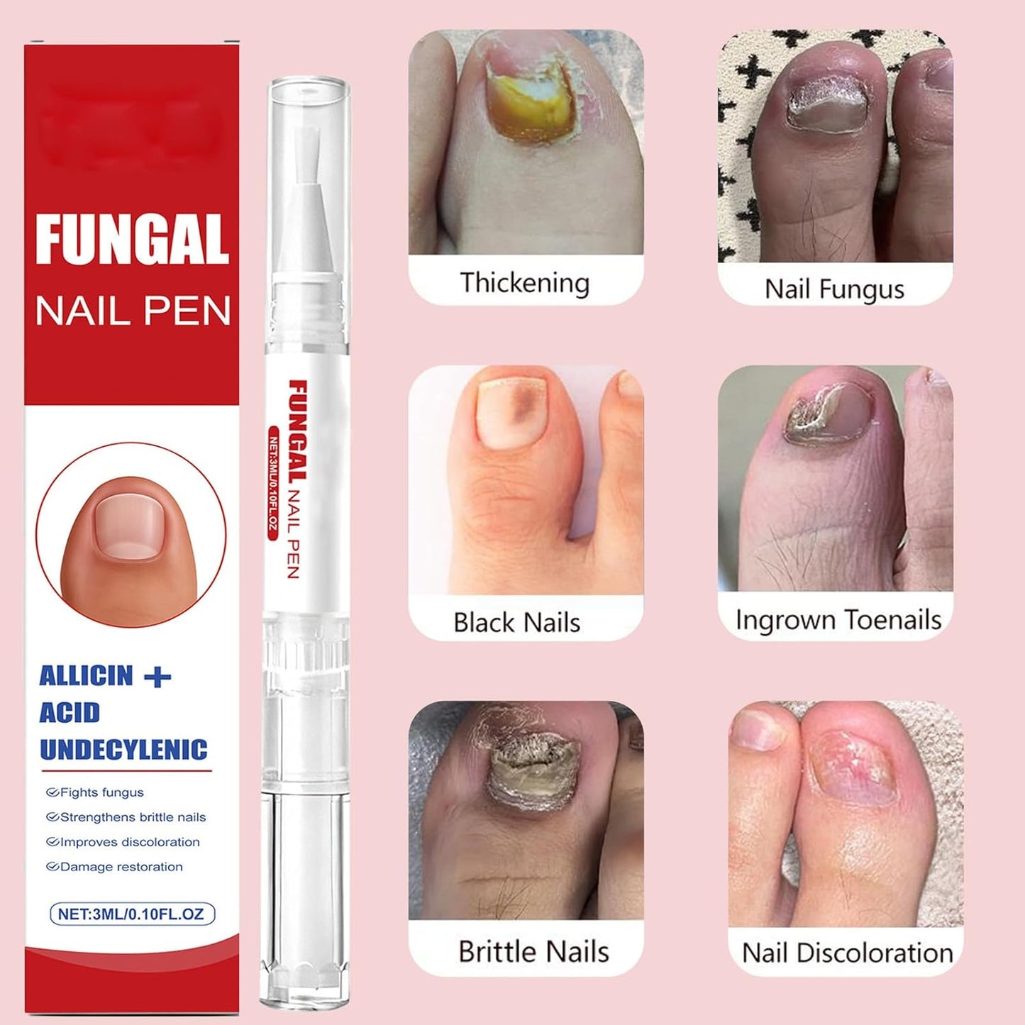 2pcs Fungal Nail Pens For Extra Strength Nail, Toenail & Fingernail Care