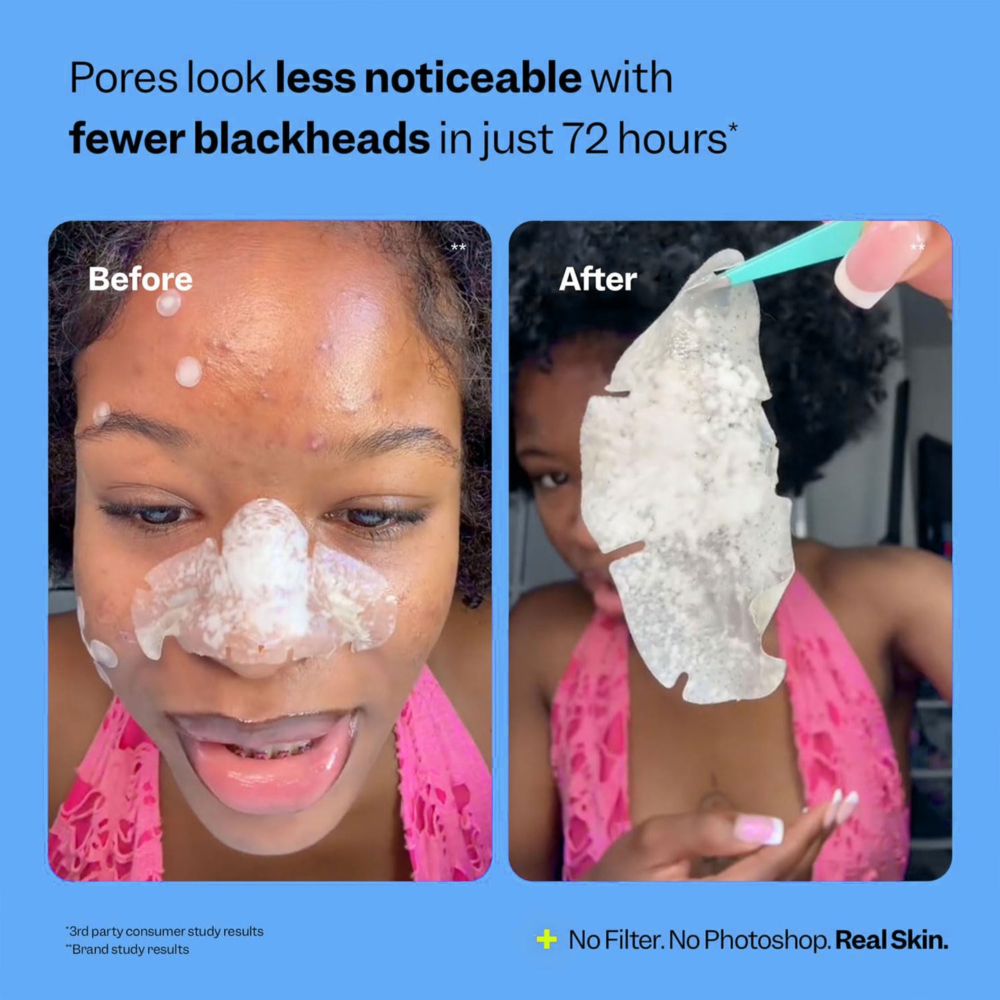 Nose Pore Patches (7 ct) - Overnight Blackhead Remover